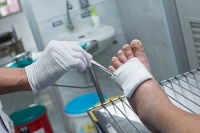 Tips for Preventing Diabetic Foot Ulcers