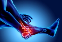 Seeing a Podiatrist for Rheumatoid Arthritis of the Feet
