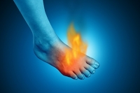 Causes of Burning Foot Pain